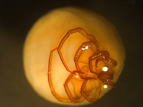 Arachnida (Mites and Spiders) Arthropod Nymph
