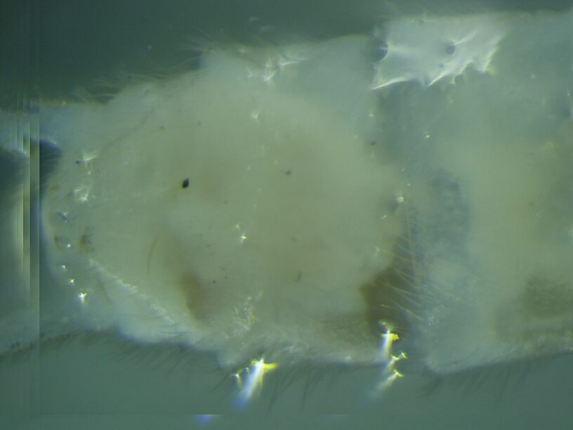Ventral view of terminal abdominal segments.  Female Suwallia pallidula (Sallfly) Stonefly Adult from Mystery Creek #237 in Montana