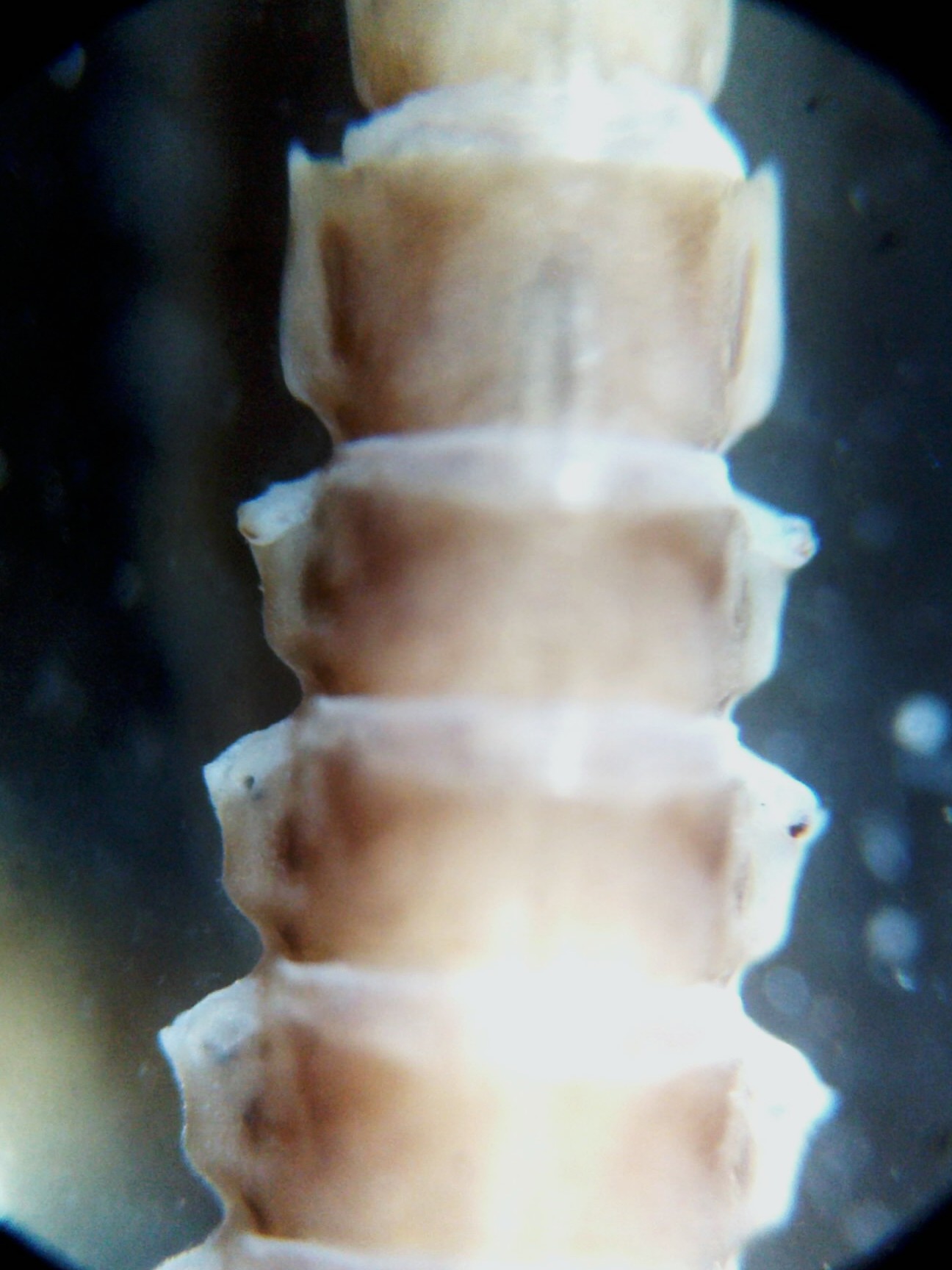 abdomen 5ish dorsal